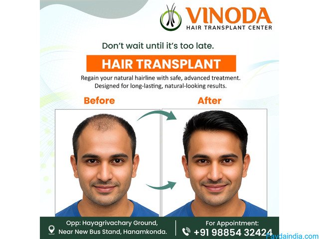 Hair Doctor In Hanamkonda