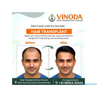 Hair Doctor In Hanamkonda