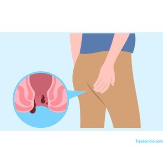 Expert Ano-Rectal Treatment in Noida for Piles & Fissure